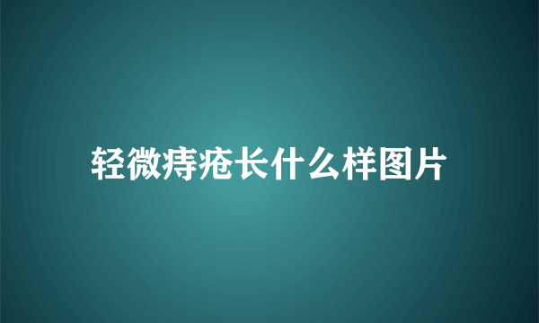 轻微痔疮长什么样图片