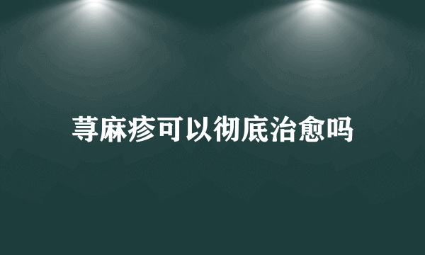 荨麻疹可以彻底治愈吗