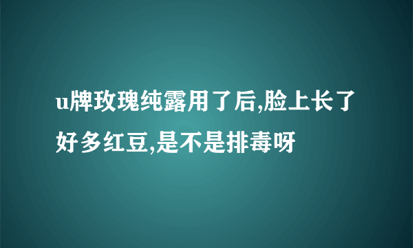 u牌玫瑰纯露用了后,脸上长了好多红豆,是不是排毒呀