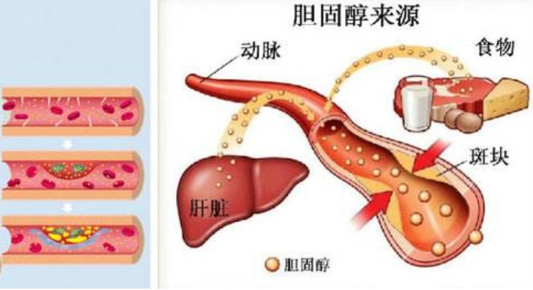 简述胆固醇在体内的生成,转化和排泄