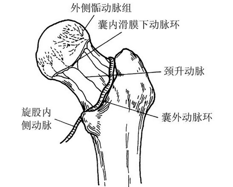 著名歌手刘欢患上“股骨头缺血性坏死”，这是什么病？有多可怕？