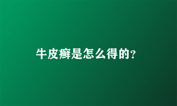 牛皮癣是怎么得的？