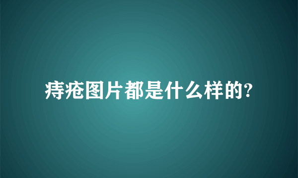 痔疮图片都是什么样的?