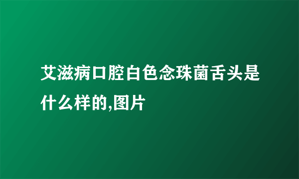 艾滋病口腔白色念珠菌舌头是什么样的,图片